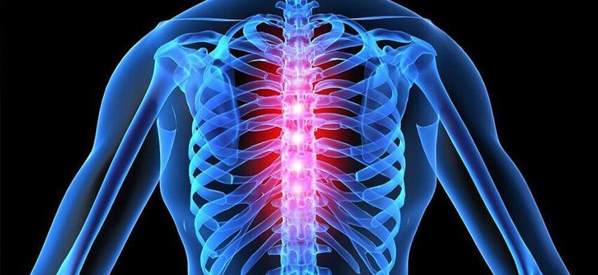 Akutní bolest je charakteristická pro exacerbaci osteochondrózy hrudní páteře