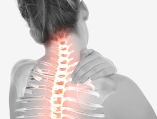 Osteochondroza v oblasti děložního čípku