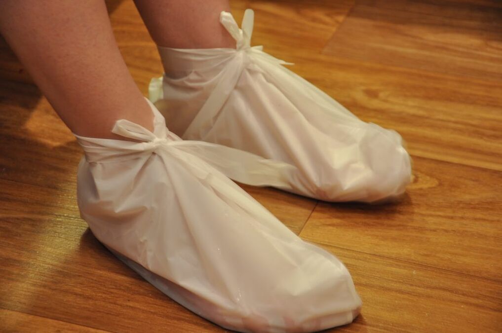 obklady na artrózu kotníku