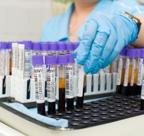 krevní test k diagnostice bolesti kloubů