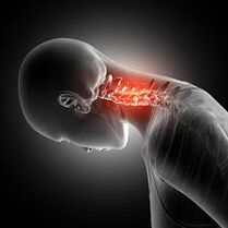 Cervikální osteochondróza