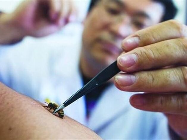 apiterapie pro cervikální osteochondrózu